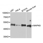 Western blot analysis of extracts of various cell lines, using MAPK8 antibody (abx000671) at 1/1000 dilution.