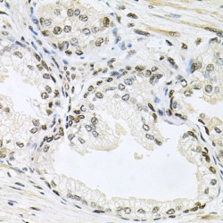 Mitogen-Activated Protein Kinase 8 / JNK1 (MAPK8) Antibody