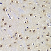 Immunohistochemistry of paraffin-embedded rat brain using CDKN1B Antibody (abx000672) at dilution of 1/200 (40x lens).