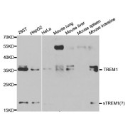 Western blot analysis of extracts of various cell lines, using TREM1 antibody (abx000673) at 1/1000 dilution.
