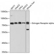 Western blot analysis of extracts of various cell lines, using ESR1 antibody (abx000676) at 1/1000 dilution.