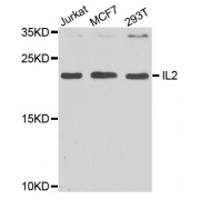 Western blot analysis of extracts of various cell lines, using IL2 antibody (abx000679) at 1/1000 dilution.