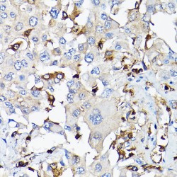 Insulin-Like Growth Factor I (IGF1) Antibody