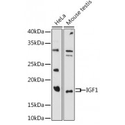 Western blot analysis of extracts of various cell lines, using IGF1 antibody (1/1000 dilution).