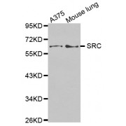 Western blot analysis of extracts of various cell lines, using SRC antibody (abx000684).