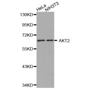 Western blot analysis of extracts of various cell lines, using AKT2 antibody (abx000688).