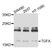 Western blot analysis of extracts of various cell lines, using TGFA antibody (abx000689) at 1/1000 dilution.
