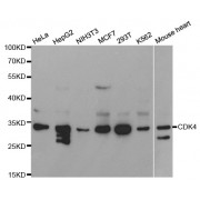 Western blot analysis of extracts of various cell lines, using CDK4 antibody (abx000696) at 1/1000 dilution.