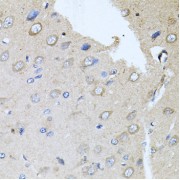 Immunohistochemistry of paraffin-embedded rat brain using RARA antibody (abx000697) at dilution of 1/100 (40x lens).