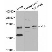 Western blot analysis of extracts of various cell lines, using VHL antibody (abx000699) at 1/1000 dilution.
