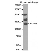Western blot analysis of extracts of mouse brain, using NCAM1 antibody (abx000705).