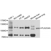 Western blot analysis of extracts of various cell lines, using PLA2G4A antibody (abx000706) at 1/1000 dilution.