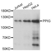 Western blot analysis of extracts of various cell lines, using PPIG antibody (abx000715) at 1/1000 dilution.