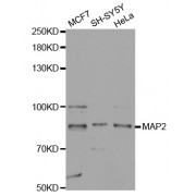 Western blot analysis of extracts of various cell lines, using MAP2 antibody (abx000724) at 1/1000 dilution.