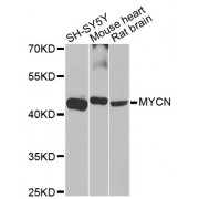 Western blot analysis of extracts of various cell lines, using MYCN antibody (abx000732) at 1/1000 dilution.