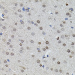 N-Myc Proto-Oncogene Protein (MYCN) Antibody