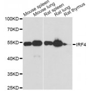 Western blot analysis of extracts of various cell lines, using IRF4 antibody (abx000742) at 1:3000 dilution.