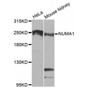 Western blot analysis of extracts of various cell lines, using NUMA1 antibody (abx000744) at 1/1000 dilution.