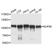 Western blot analysis of extracts of various cell lines, using NUP98 antibody (abx000745) at 1/1000 dilution.