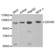 Western blot analysis of extracts of various cell lines, using DDX58 antibody (abx000755) at 1/1000 dilution.