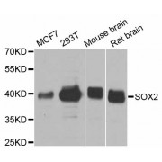 Western blot analysis of extracts of various cell lines, using SOX2 antibody (abx000763) at 1/1000 dilution.