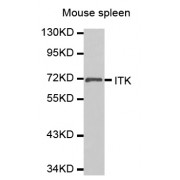 Western blot analysis of extracts of mouse spleen, using ITK antibody (abx000765).