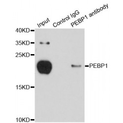 Phosphatidylethanolamine Binding Protein 1 (PEBP1) Antibody