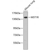Western blot analysis of extracts of mouse lung, using MST1R antibody (abx000773).