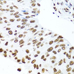 Lupus La Protein (SSB) Antibody