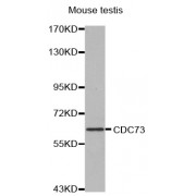 Western blot analysis of extracts of mouse testis, using CDC73 antibody (abx000790).