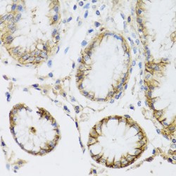 Sodium/Potassium-Transporting ATPase Subunit Alpha 1 (ATP1A1) Antibody