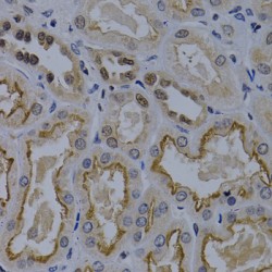 Tumor Necrosis Factor Receptor Superfamily Member 6B (TNFRSF6B) Antibody