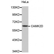 Western blot analysis of extracts of HeLa cells, using CAMK2D antibody (abx000799).