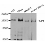 Western blot analysis of extracts of various cell lines, using TJP1 antibody (abx000800) at 1/1000 dilution.