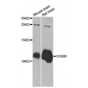 Western blot analysis of extracts of various cell lines, using S100B antibody (abx000811) at 1/1000 dilution.