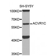Western blot analysis of extracts of SH-SY5Y cells, using ACVR1C antibody (abx000813) at 1/1000 dilution.