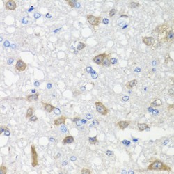 Activin A Receptor Type 1C (ACVR1C) Antibody