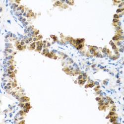 Activin A Receptor Type 1C (ACVR1C) Antibody