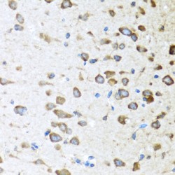 Activin A Receptor Type 1C (ACVR1C) Antibody