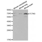 Western blot analysis of extracts of various cell lines, using TCTN3 antibody (abx000819) at 1/500 dilution.