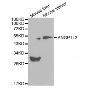 Western blot analysis of extracts of various cell lines, using ANGPTL3 antibody (abx000824) at 1/1000 dilution.