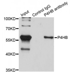 Protein Disulfide-Isomerase (P4HB) Antibody
