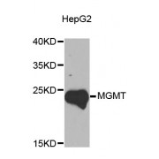 Western blot analysis of extracts of HepG2 cells, using MGMT antibody (abx000828) at 1/1000 dilution.