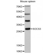 Western blot analysis of extracts of mouse spleen, using SOCS3 antibody (abx000829) at 1:3000 dilution.