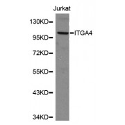 Western blot analysis of extracts of Jurkat cells, using ITGA4 antibody (abx000831).