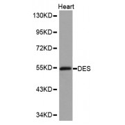 Western blot analysis of extracts of mouse heart, using DES antibody (abx000834).