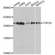 Western blot analysis of extracts of various cell lines, using TOP2A antibody (abx000841) at 1/1000 dilution.