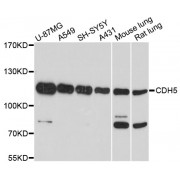 Western blot analysis of extracts of various cell lines, using CDH5 antibody (abx000842) at 1/1000 dilution.