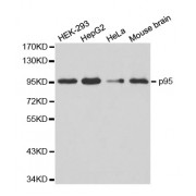 Western blot analysis of extracts of various cell lines, using NBN antibody (abx000860).
