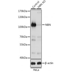 Nibrin (NBN) Antibody
